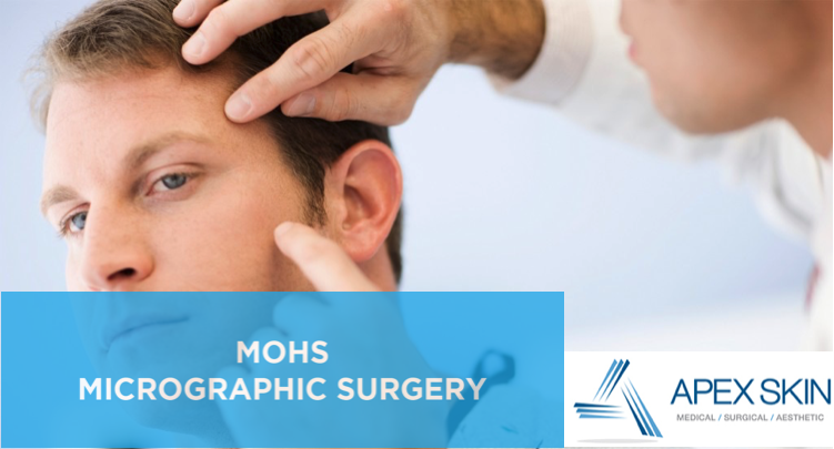 MOHS