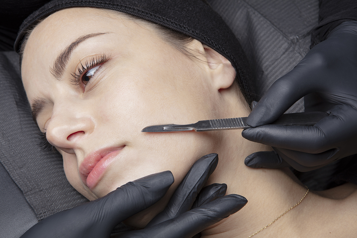 Dermaplaning before and after