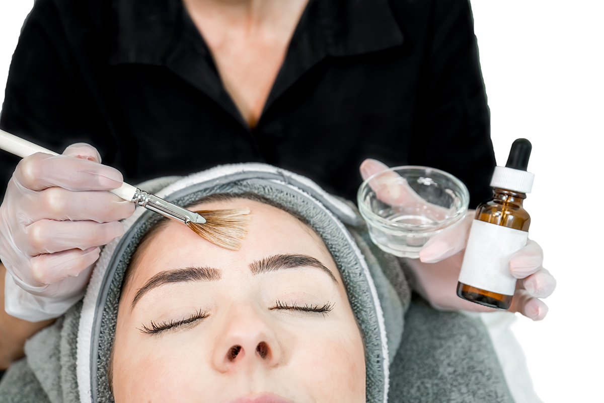 chemical peeling treatment