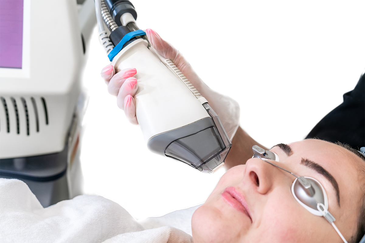 Fraxel DUAL laser treatment