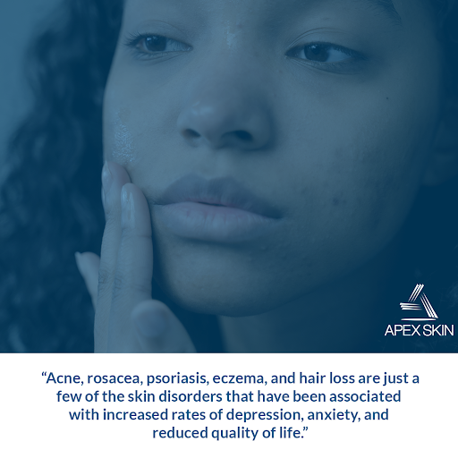 acne and mental health
