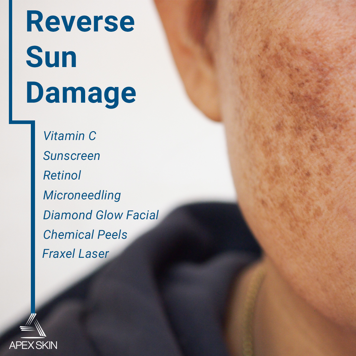 repair sun damage