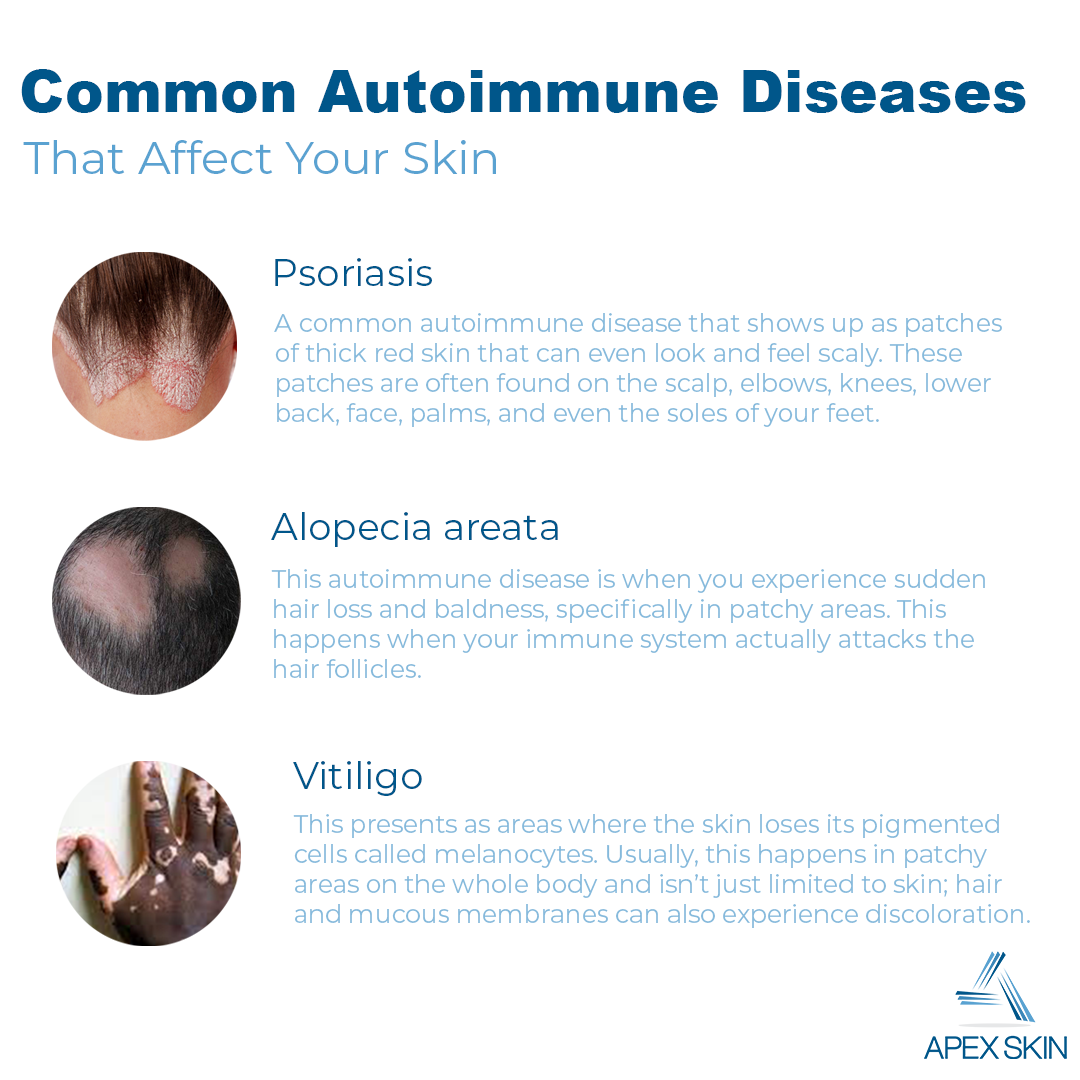 autoimmune diseases