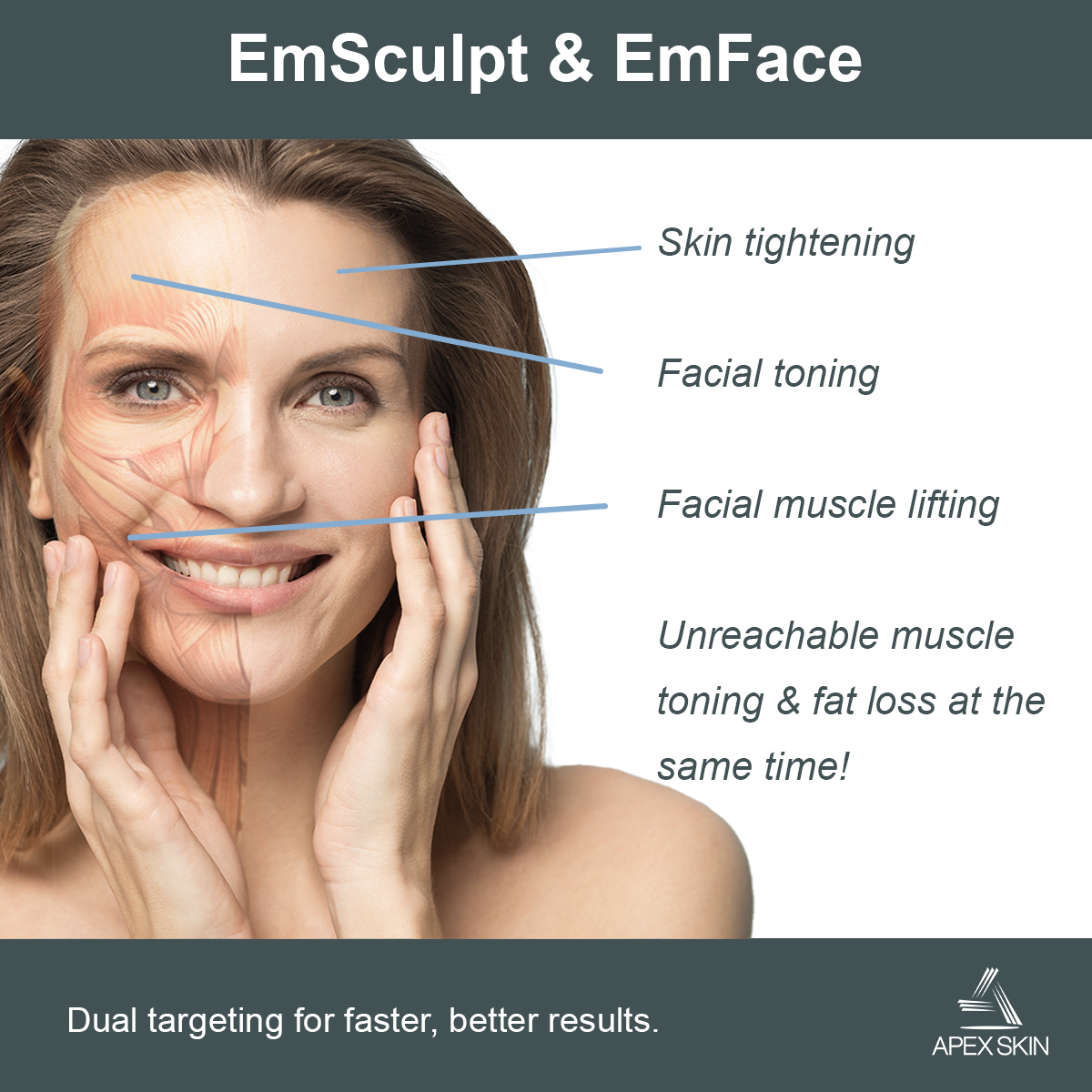 emsculpt and emface