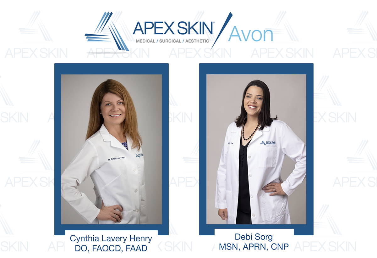 APEX SKIN AVON