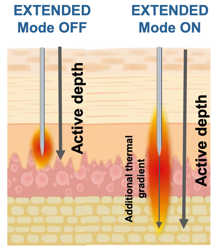 exion treatment