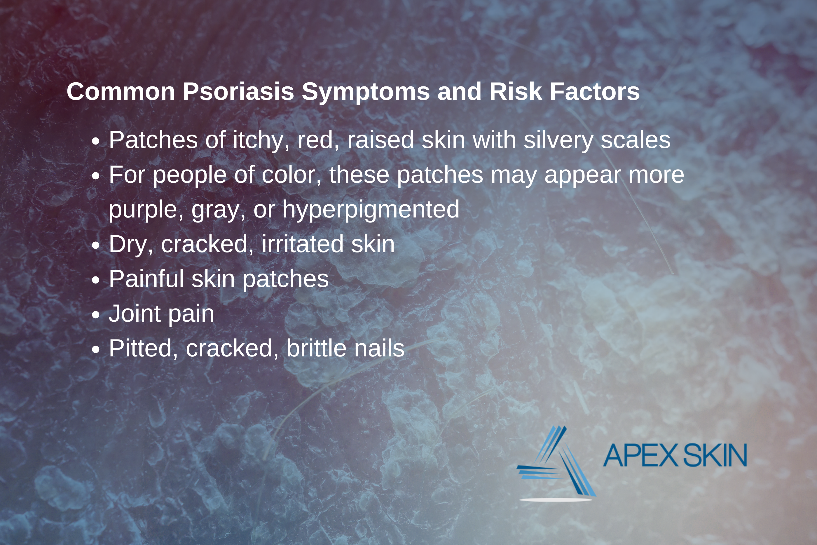 Psoriasis Symptoms
